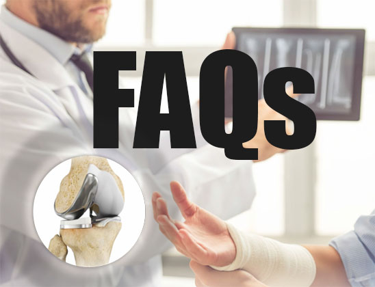FAQ - Frequently Asked Questions about Joint Surgery
